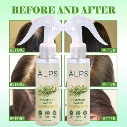 Rosemary Water | Spray For Hair Regrowth Buy 1 Get 2 Free