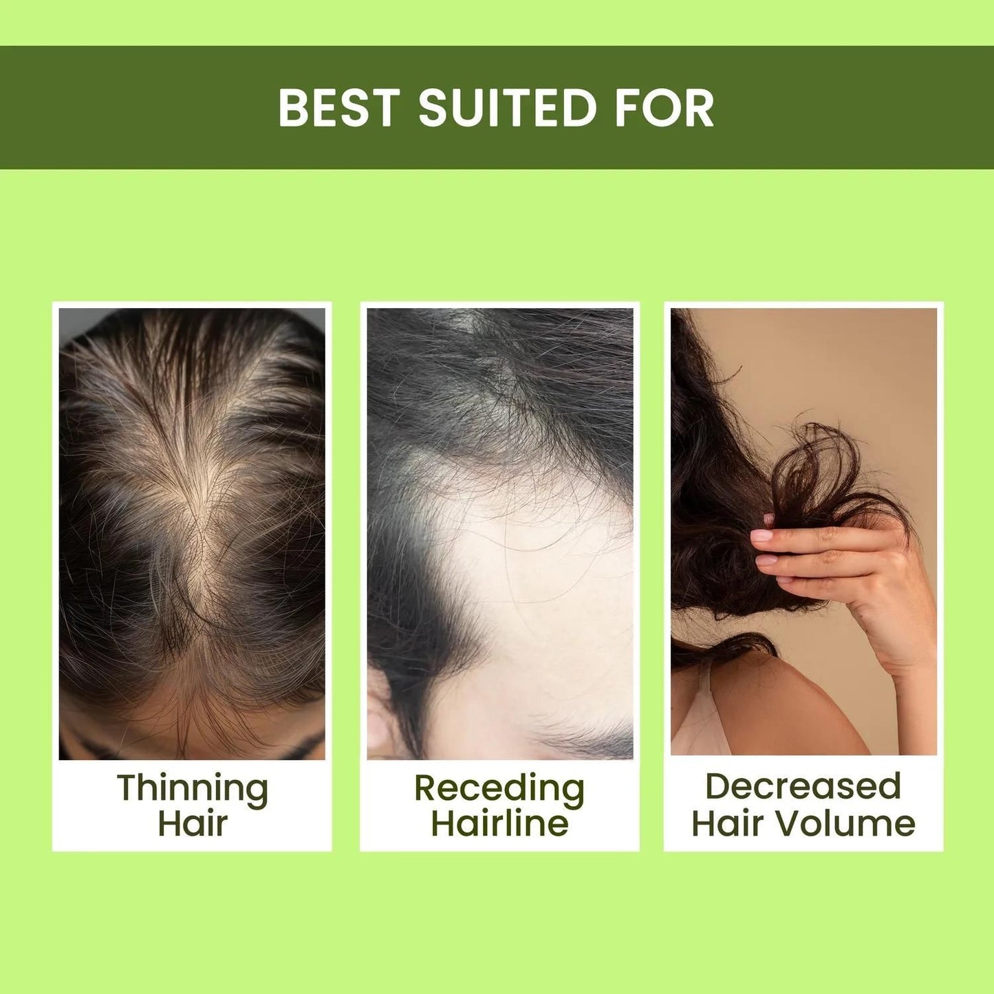Rosemary Water | Spray For Hair Regrowth Buy 1 Get 2 Free